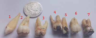 #ad 7 RARE Antique HUMAN Tooth I Teeth MOLAR w ROOTS Pendant Some w Silver Fillings $245.50