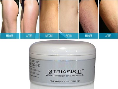 #ad Precious Skin Body Cream Eliminate Stretch Mark for Whitening Skin 180 4 oz $900.85