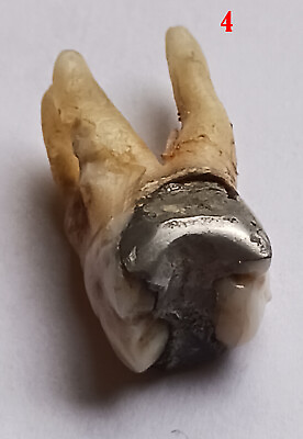 #ad RARE Antique HUMAN Tooth Teeth MOLAR w ROOTS SILVER Filling $44.90