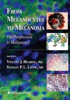 #ad Vincent J. Hearing From Melanocytes to Melanoma Paperback UK IMPORT $209.79