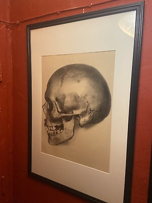 #ad Antique Human Skull Lithograph Anatomy Medical 19th C. Large Dr. Emil Bannwarth $950.00