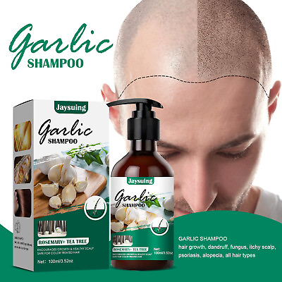 #ad Anti itching Hair Anti dandruff Shampoo $11.99