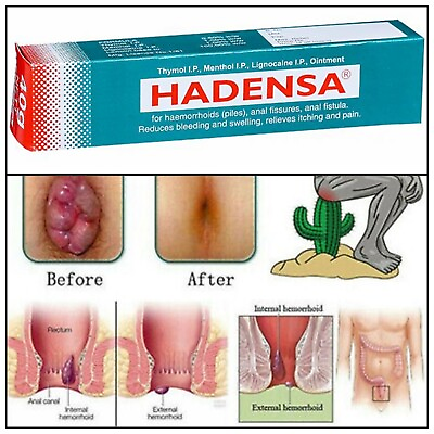 #ad Hadensa Ointment used in the treatment of piles 20gm fissures and anal fistula. $11.39
