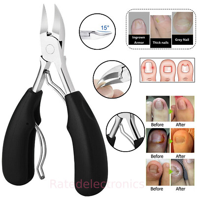 #ad Heavy Duty Toenail Clippers for Thick Ingrown Toe Nails Precision Nail Scissors $6.67